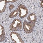 CDK5RAP3 Antibody in Immunohistochemistry (Paraffin) (IHC (P))