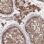 CDK5RAP3 Antibody in Immunohistochemistry (Paraffin) (IHC (P))