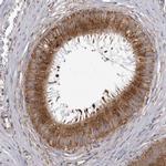 CDK5RAP3 Antibody in Immunohistochemistry (IHC)