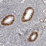 NUP153 Antibody in Immunohistochemistry (Paraffin) (IHC (P))