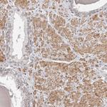 NUP153 Antibody in Immunohistochemistry (Paraffin) (IHC (P))