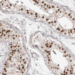 NUP153 Antibody in Immunohistochemistry (Paraffin) (IHC (P))