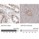 NUP153 Antibody