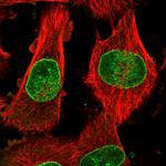 NUP153 Antibody in Immunocytochemistry (ICC/IF)