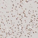 NUP153 Antibody in Immunohistochemistry (Paraffin) (IHC (P))