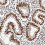 NUP153 Antibody in Immunohistochemistry (Paraffin) (IHC (P))