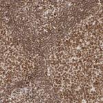 NUP153 Antibody in Immunohistochemistry (Paraffin) (IHC (P))