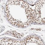 NUP153 Antibody in Immunohistochemistry (Paraffin) (IHC (P))