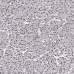 NUP153 Antibody in Immunohistochemistry (IHC)