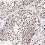 NUP153 Antibody in Immunohistochemistry (IHC)