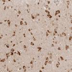 EEF1E1 Antibody in Immunohistochemistry (Paraffin) (IHC (P))