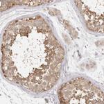 EEF1E1 Antibody in Immunohistochemistry (IHC)