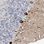 AIDA Antibody in Immunohistochemistry (Paraffin) (IHC (P))