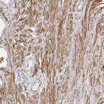 UNK Antibody in Immunohistochemistry (Paraffin) (IHC (P))