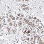 ODF2L Antibody in Immunohistochemistry (Paraffin) (IHC (P))