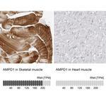 AMPD1 Antibody in Immunohistochemistry (IHC)