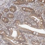 ODF2L Antibody in Immunohistochemistry (Paraffin) (IHC (P))