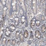 CDCA8 Antibody in Immunohistochemistry (Paraffin) (IHC (P))