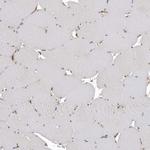 CDCA8 Antibody in Immunohistochemistry (Paraffin) (IHC (P))