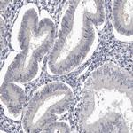 CDCA8 Antibody in Immunohistochemistry (IHC)