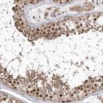 CDCA8 Antibody in Immunohistochemistry (IHC)