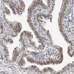 WRAP53 Antibody in Immunohistochemistry (IHC)