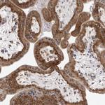 MRPS15 Antibody in Immunohistochemistry (Paraffin) (IHC (P))