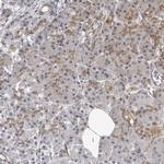 MRPS15 Antibody in Immunohistochemistry (IHC)