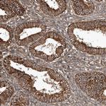 SNAP47 Antibody in Immunohistochemistry (IHC)