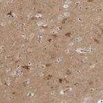 SRGAP2 Antibody in Immunohistochemistry (IHC)