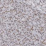 HP1BP3 Antibody in Immunohistochemistry (Paraffin) (IHC (P))