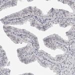 DDX54 Antibody in Immunohistochemistry (IHC)