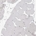 DDX54 Antibody in Immunohistochemistry (IHC)