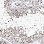 CDCA8 Antibody in Immunohistochemistry (IHC)