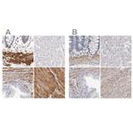 LMOD1 Antibody in Immunohistochemistry (IHC)