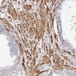 LMOD1 Antibody in Immunohistochemistry (IHC)