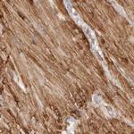 LMOD1 Antibody in Immunohistochemistry (IHC)