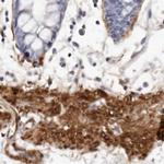 LMOD1 Antibody in Immunohistochemistry (IHC)