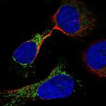 ODF2L Antibody in Immunocytochemistry (ICC/IF)