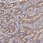 ODF2L Antibody in Immunohistochemistry (Paraffin) (IHC (P))