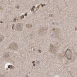 CEP350 Antibody in Immunohistochemistry (IHC)