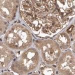 CEP350 Antibody in Immunohistochemistry (IHC)