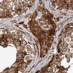 CEP350 Antibody in Immunohistochemistry (IHC)