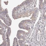 USP21 Antibody in Immunohistochemistry (Paraffin) (IHC (P))