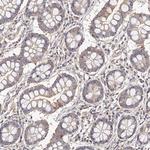 USP21 Antibody in Immunohistochemistry (Paraffin) (IHC (P))