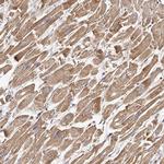 USP21 Antibody in Immunohistochemistry (Paraffin) (IHC (P))