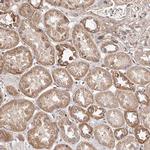 USP21 Antibody in Immunohistochemistry (Paraffin) (IHC (P))