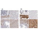 LMOD1 Antibody in Immunohistochemistry (IHC)