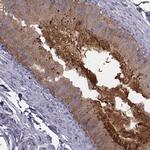 CRISP1 Antibody in Immunohistochemistry (IHC)