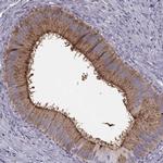 CRISP1 Antibody in Immunohistochemistry (IHC)